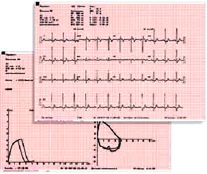 ������ 6/12 - ��������� ����������������� CARDIOVIT AT-102  � �������� �� �������