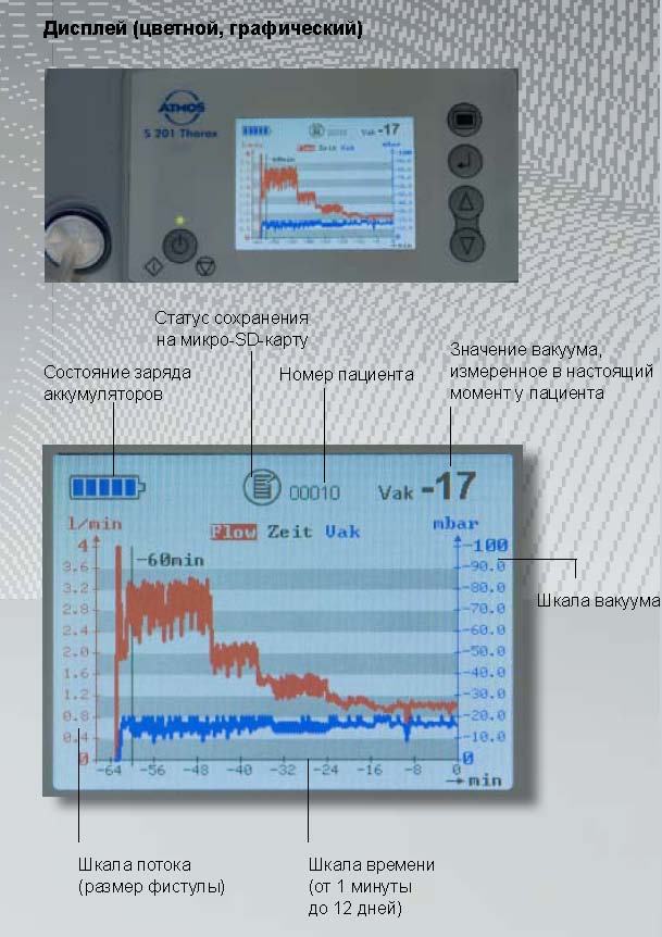 Купить отсасыватель медицинский ATMOS<br />
Thorax у компании МТ Техника