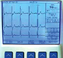 ����������������� Schiller ������������������� CARDIOVIT AT-102
