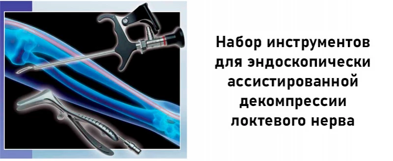 Инструменты для эндоскопически ассистированной декомпрессии локтевого нерва