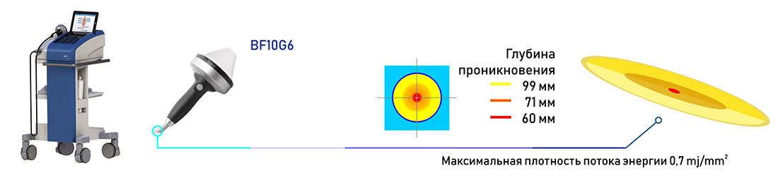 Kомплект оборудования Richard Wolf PLUS 60